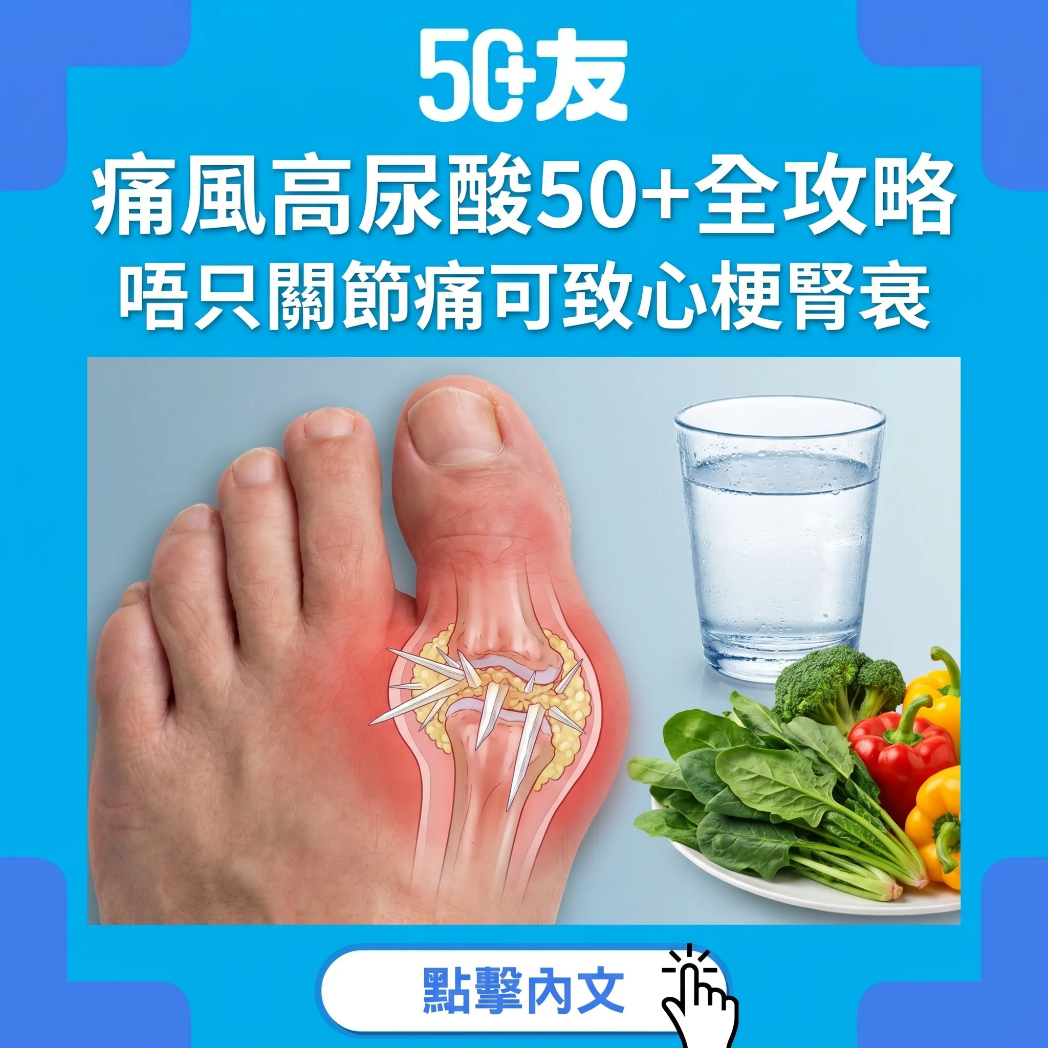 痛風唔只關節痛！高尿酸50+隱形炸彈：心梗+腎衰+中風