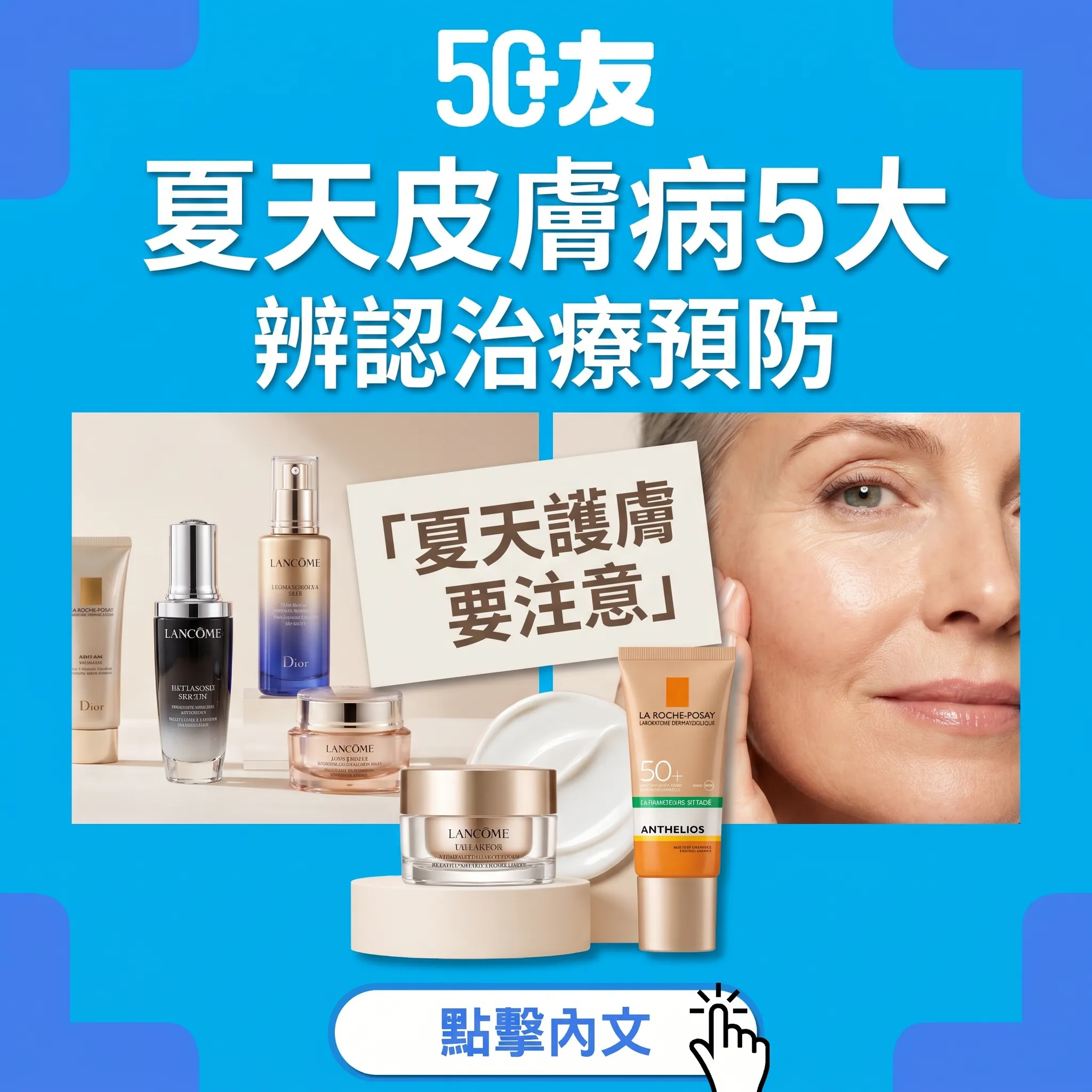50+夏天皮膚病5大！辨認加治療加預防