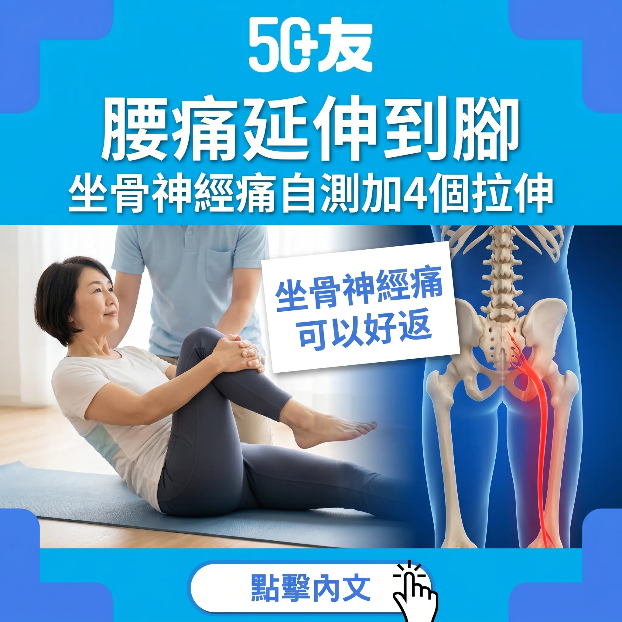 50+坐骨神經痛自測加4個拉伸加港安微創手術全攻略