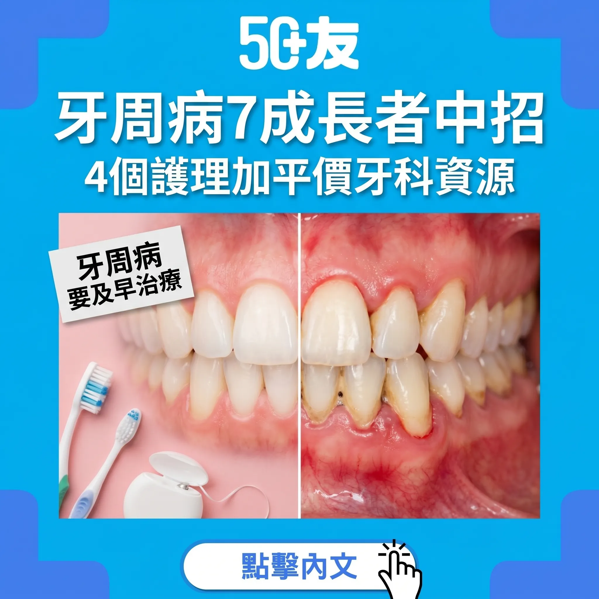 50+牙周病7成中招！4個護理方法加香港平價牙科