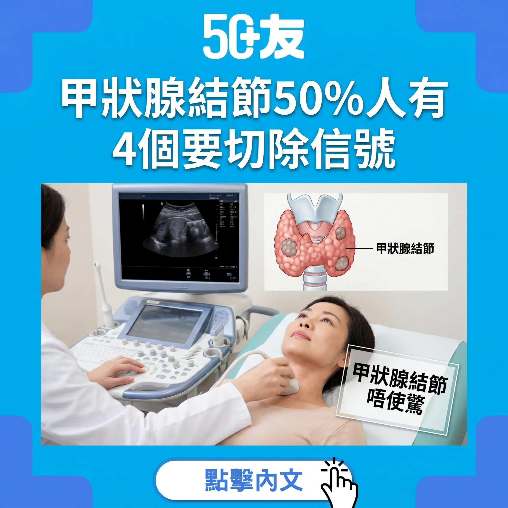 50+甲狀腺結節50%人有！4個要切除信號加香港檢查資源