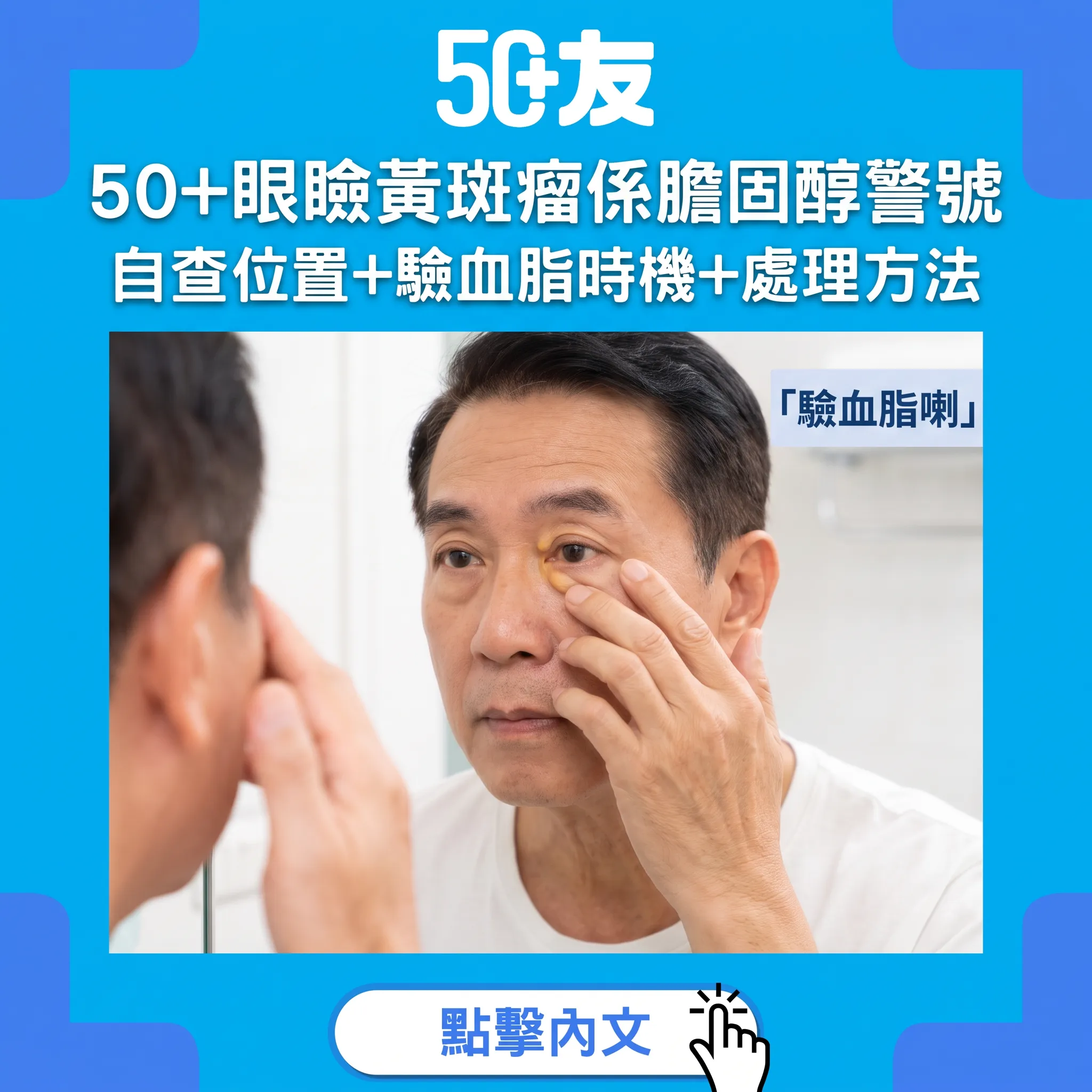 50+眼瞼黃斑瘤係膽固醇警號｜自查位置+驗血脂時機+處理方法