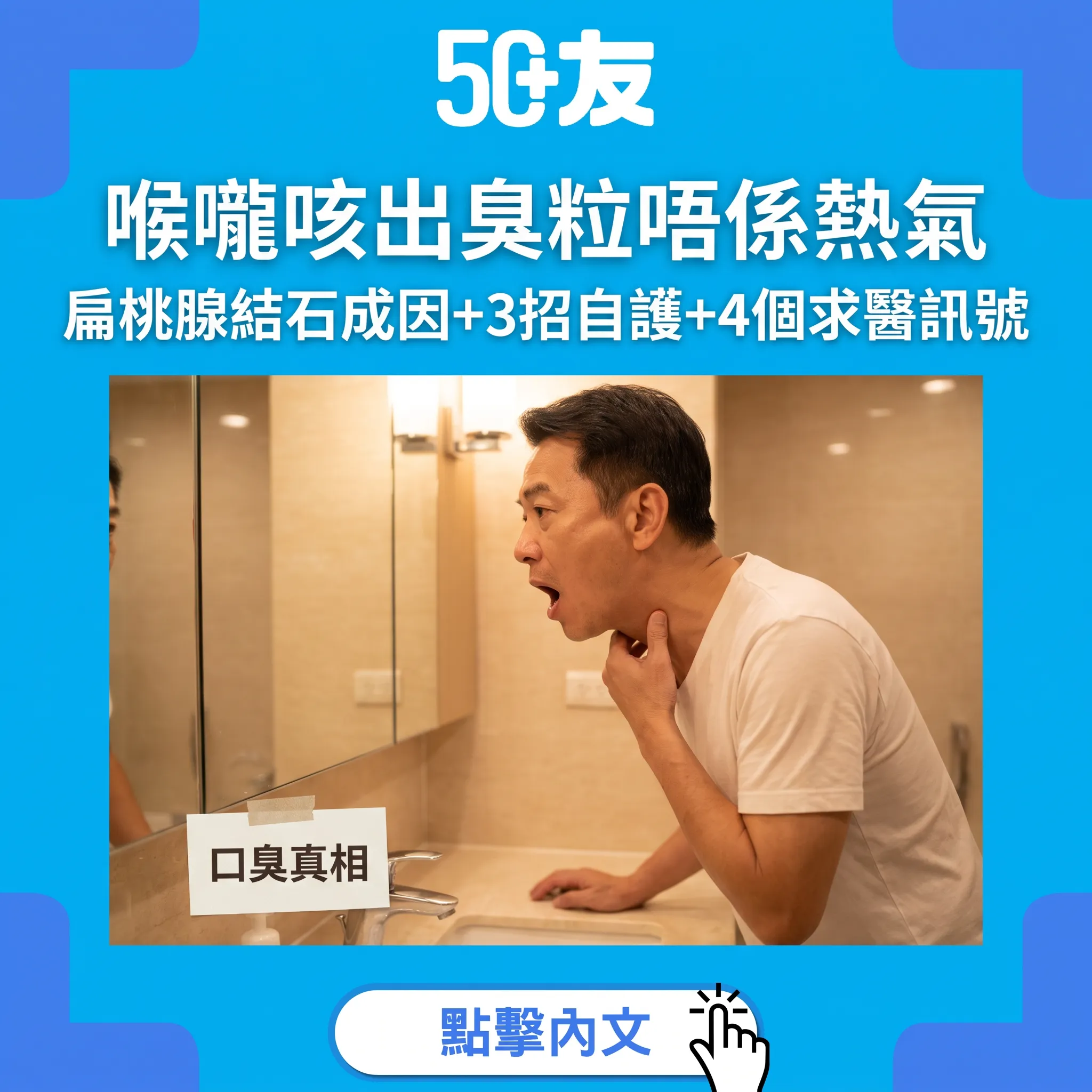 扁桃腺結石：藏喺喉嚨嘅「臭米粒」真兇