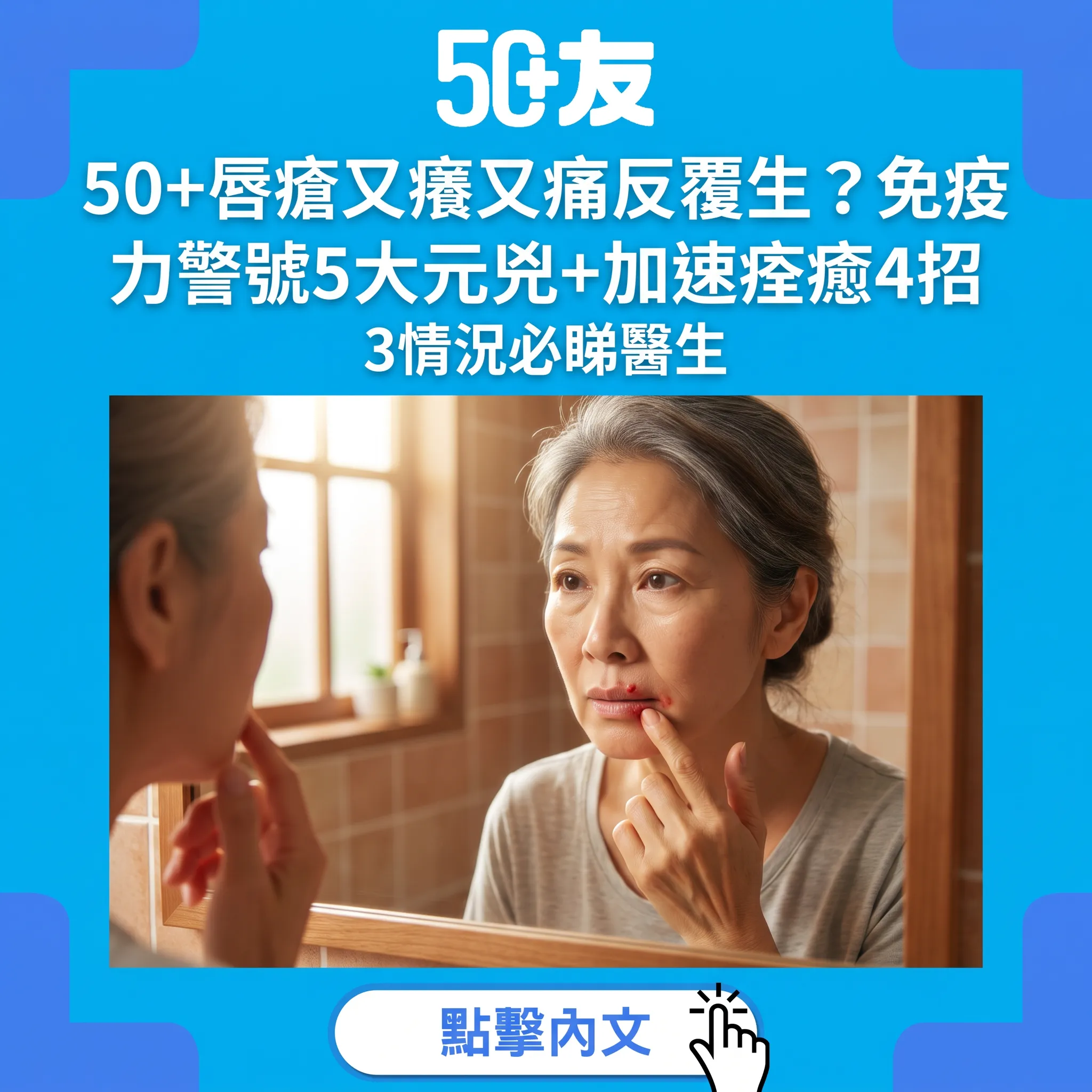 50+唇瘡反覆發作是免疫力警號？5大爆發元兇與加速痊癒4招