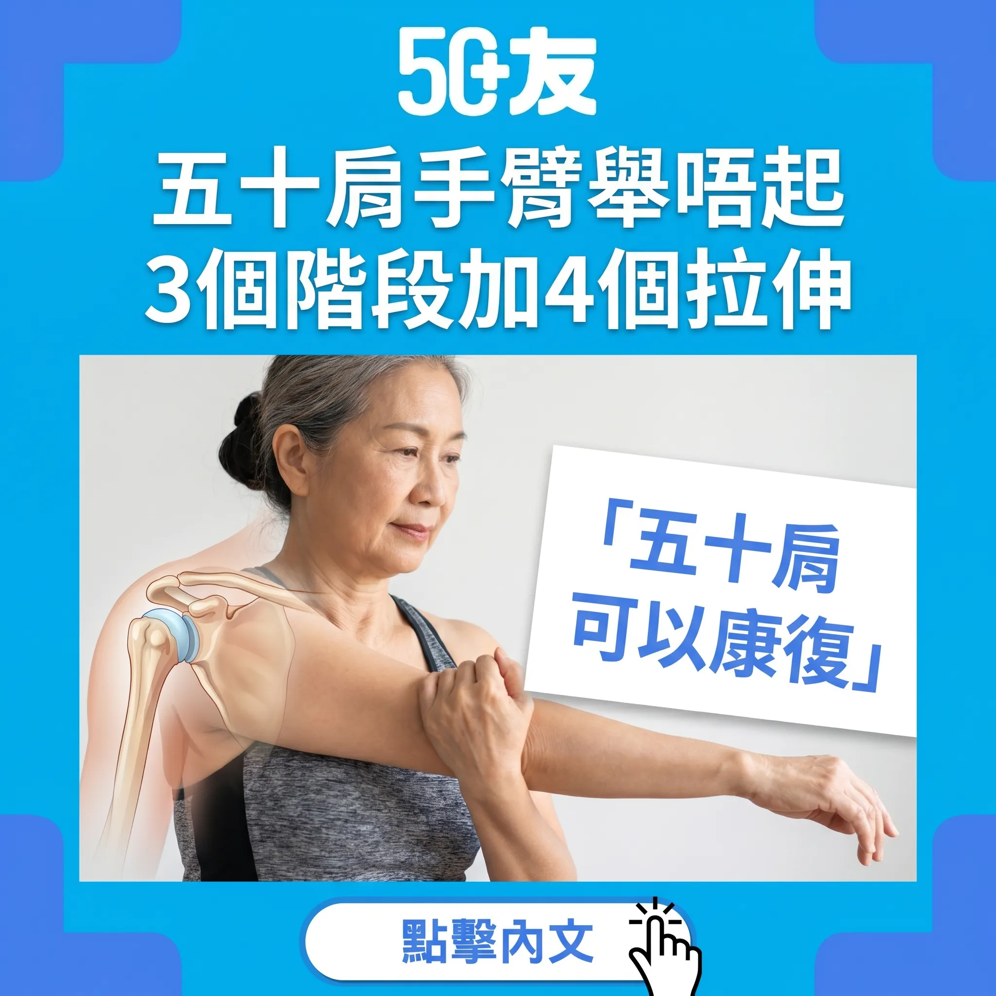 50+五十肩3個階段加4個拉伸加治療選擇