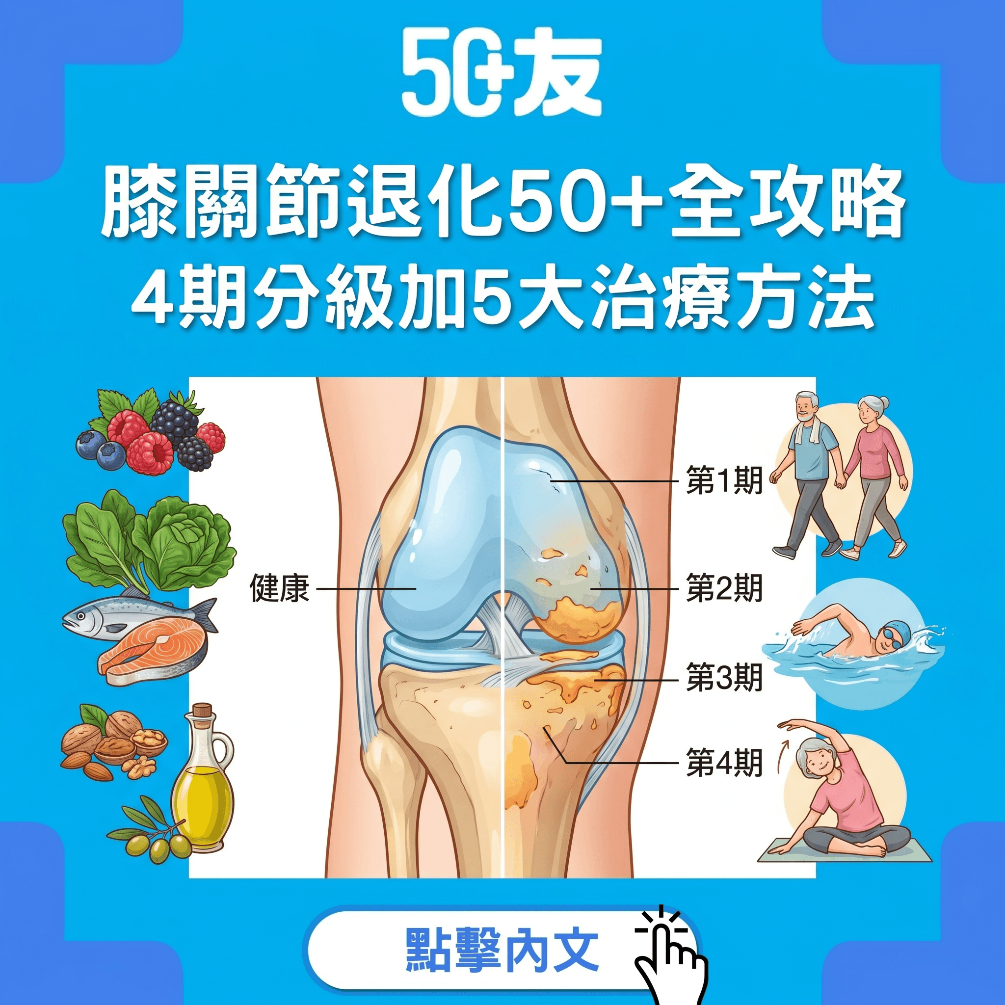 膝頭哥痛唔係老必然！退化性膝關節炎50+全攻略