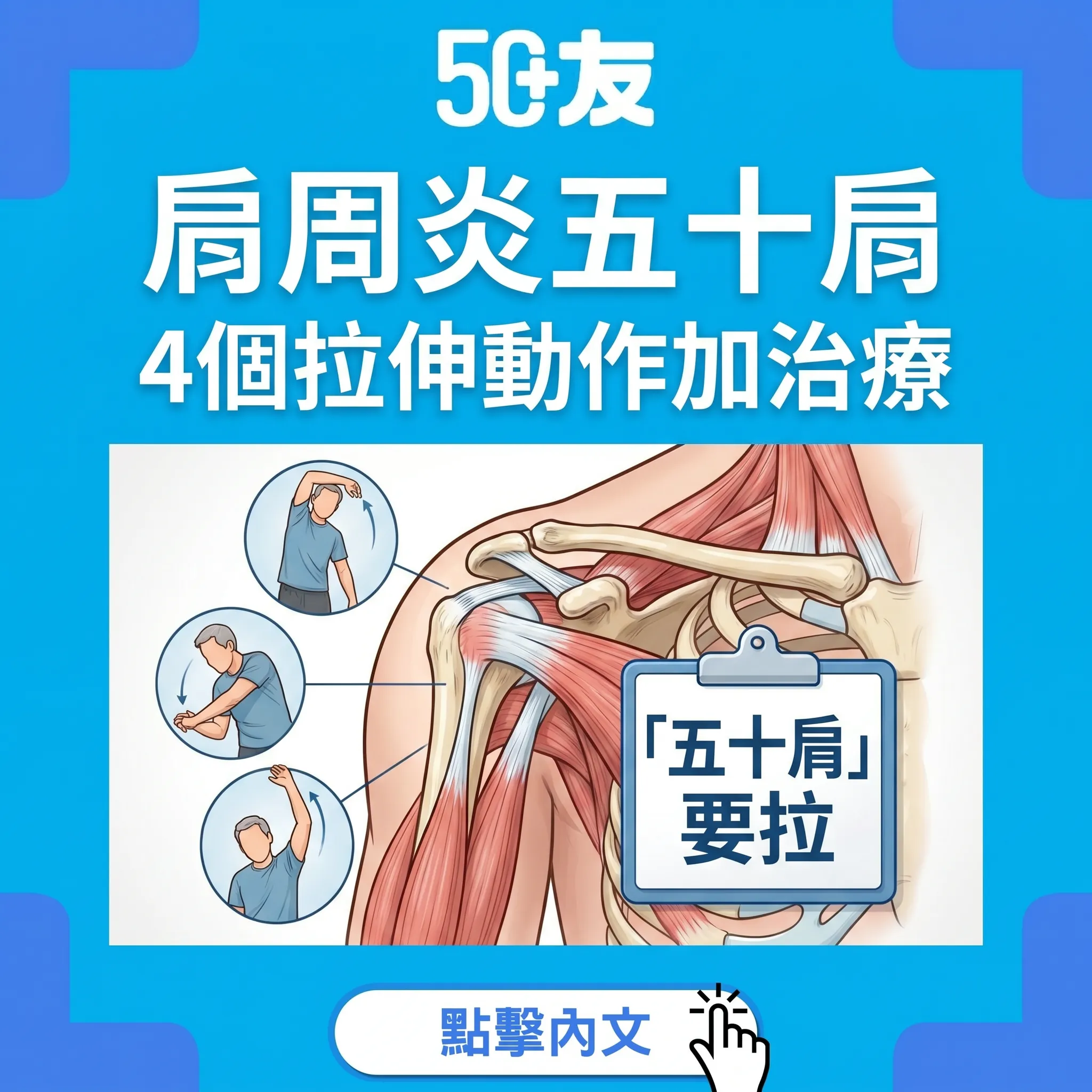 50+肩周炎五十肩！3個階段加4個拉伸動作