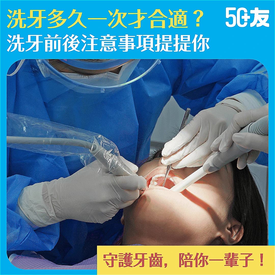 【洗牙並非只為美觀！】洗牙價錢｜頻率｜前後注意事項