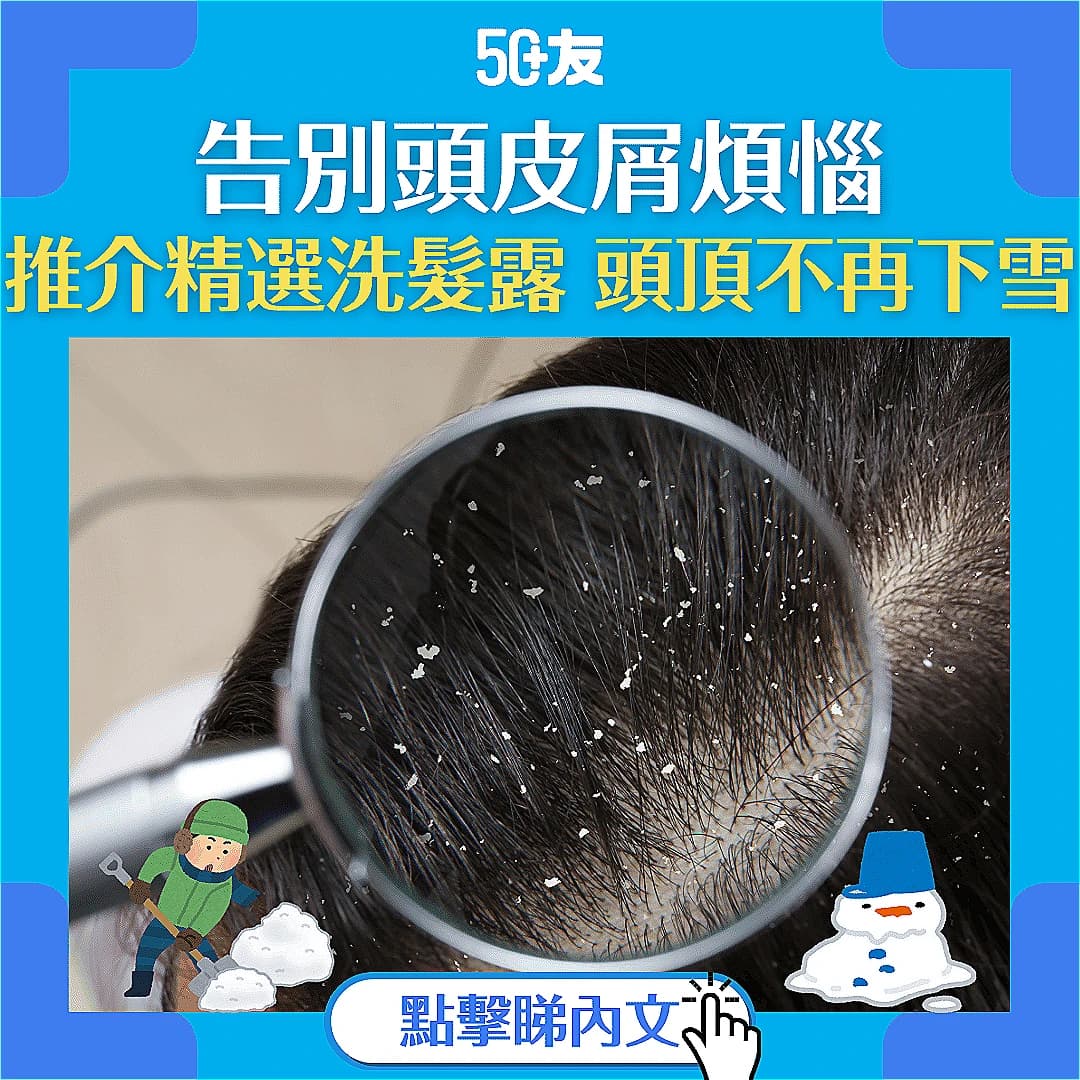 【告別頭皮屑】為你拆解「落雪」成因 + 解決辦法 (附精選洗髮露推介)