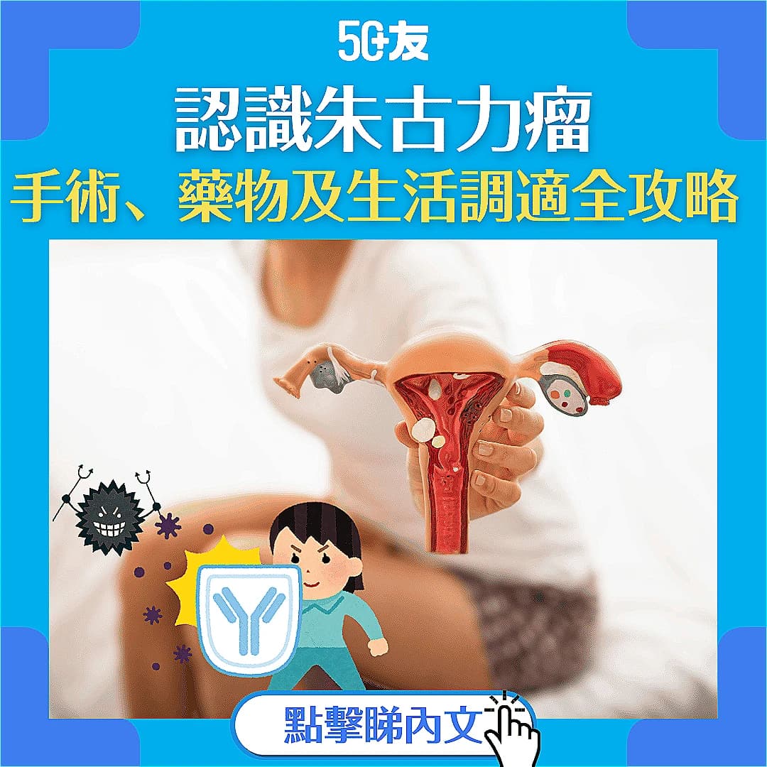 【朱古力瘤】認識朱古力瘤 手術、藥物及生活調適全攻略