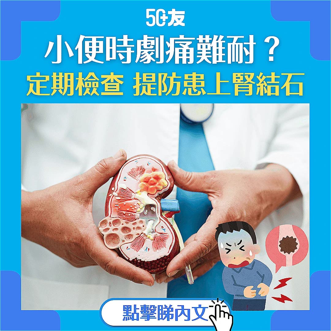 【腎結石】痛起來要人命！了解腎結石成因、症狀及預防方法