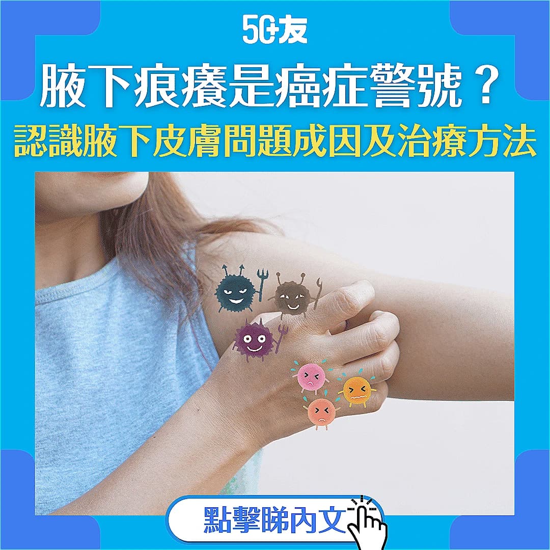 【腋下痕癢】是皮膚問題還是癌症警號？｜了解原因、症狀及治療方法