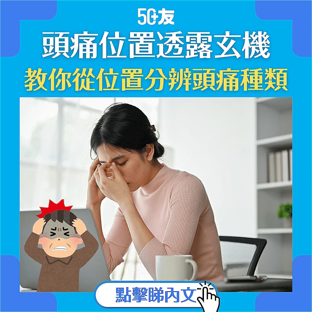 【頭痛位置有玄機？】拆解5種常見頭痛種類及舒緩方法！
