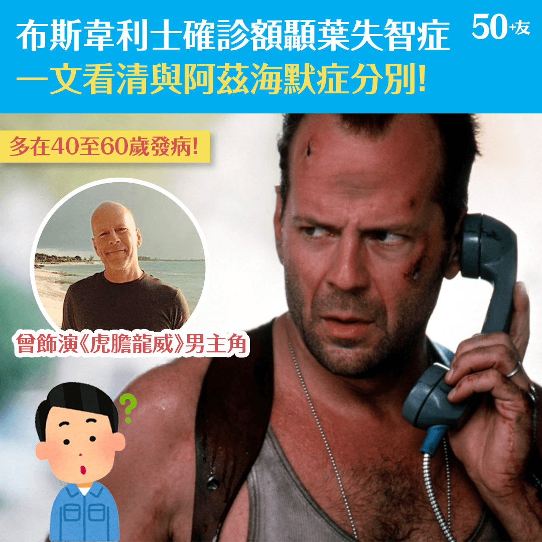 布斯韋利士確診額顳葉失智症 一文看清與阿茲海默症分別！
