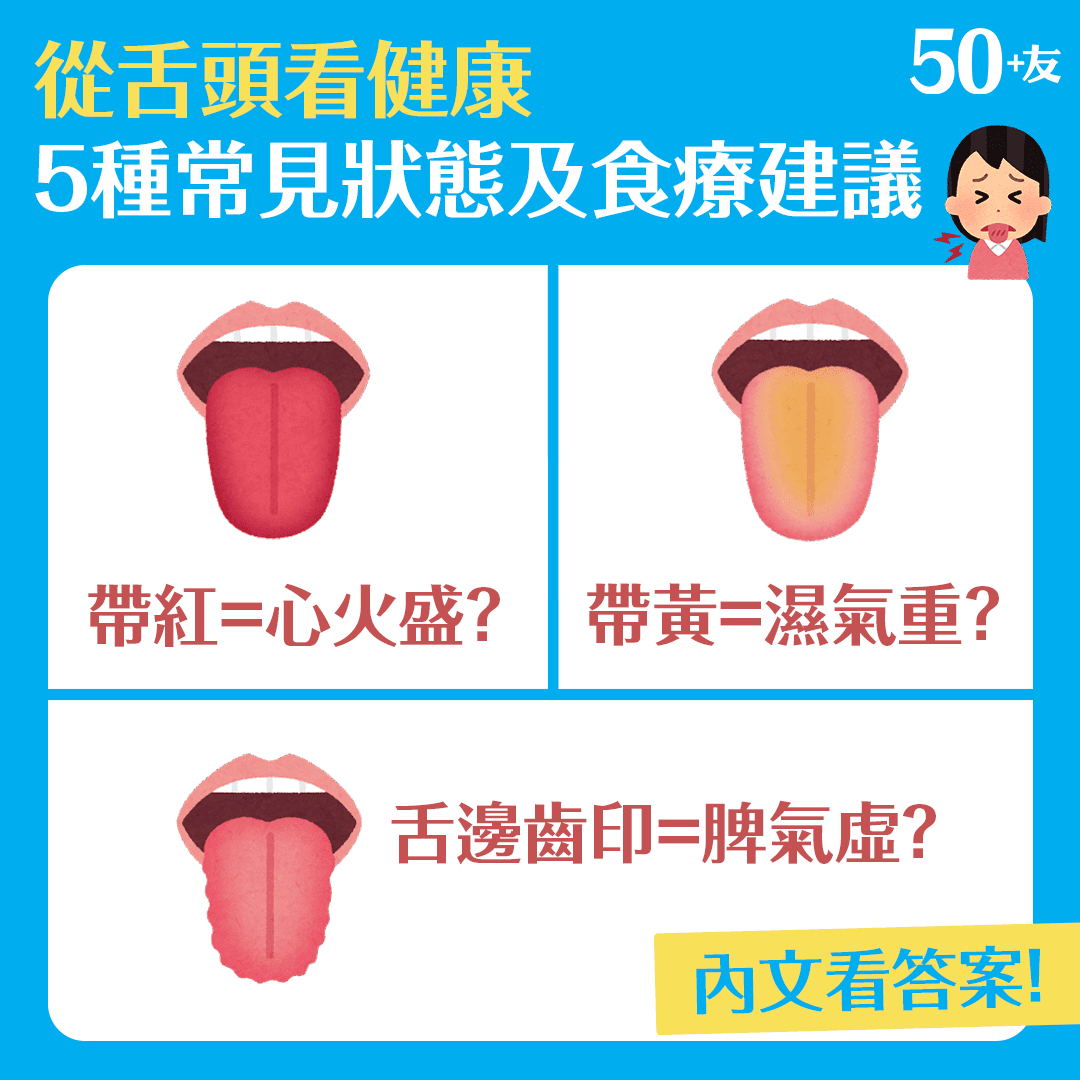 從舌頭看健康 5種常見狀態及食療建議